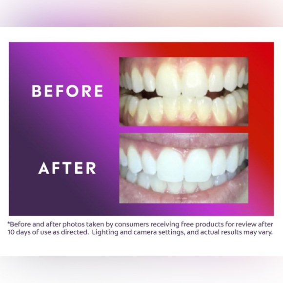 Colgate Optic White LED Whitening Kit and Toothpaste - Picture 3 of 4